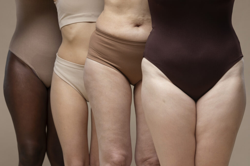 diferencia entre celulitis y grasa localizada